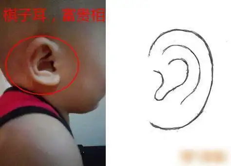 开始富贵棋子耳是指双耳圆润,无尖耸,不规整外形,耳廓和耳轮相依而生