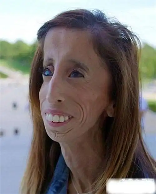 世界上最恶心的人是谁曾出演电影世界最丑人