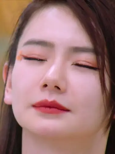 7815戚薇的双眼皮,做了很多年,仍然是痕迹比较明显的_圈子-新氧