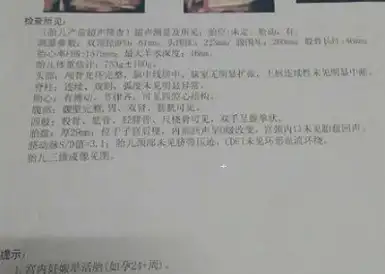 不妨看b超单上的这3个数据,准确率极高!_宝宝_进行_孕妇