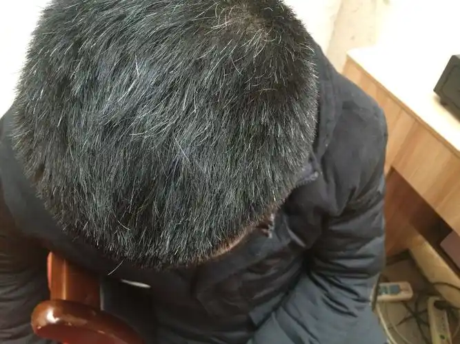 怎么使头发变黑?