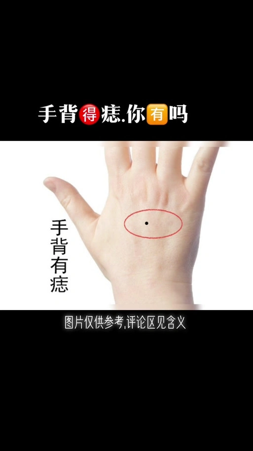 左手手背上长痣代表什么 - 抖音