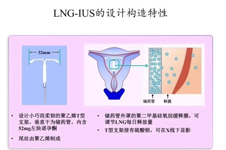 曼月乐是个什么环?_避孕_避孕治疗介绍 - 好大夫在线