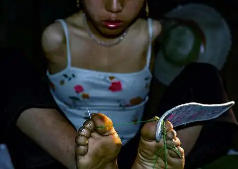 无臂女孩两腿喂奶4岁雨天触电双臂高位截肢没有被苦难打败