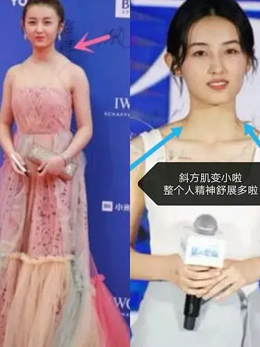 【斜方肌有多毁身材要瘦千万不能忽略斜方肌】