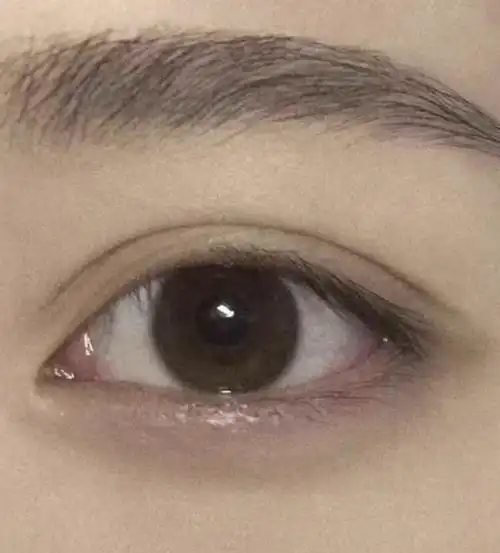 双眼皮小平行图片