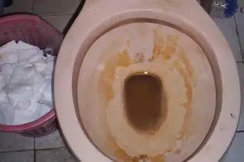 腾讯视频发布时间:2018-10-2101:00厕所马桶臭死人?