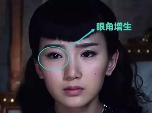 经历了男友劈腿,亲爹讹钱之后,毛晓彤的脸也整的认不出了?_眼角