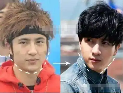 被说的最多的还是他的双眼皮,越来越宽 的双眼皮让薛之谦看着特别没有