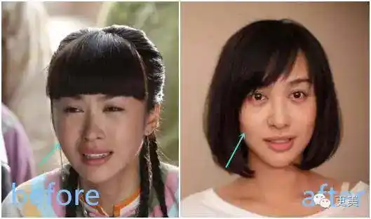 被baby夺爱的李菲儿又整容?撞脸王子文,杨紫…就是没辨识度!