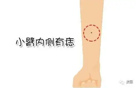 这三个地方有痣无论男女事业皆易成功