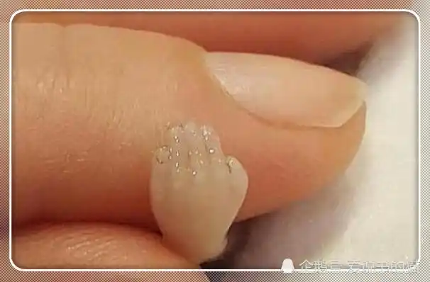 那些被打掉的"胎儿"都去哪了?医生感慨:这3种残忍结局让人心疼!