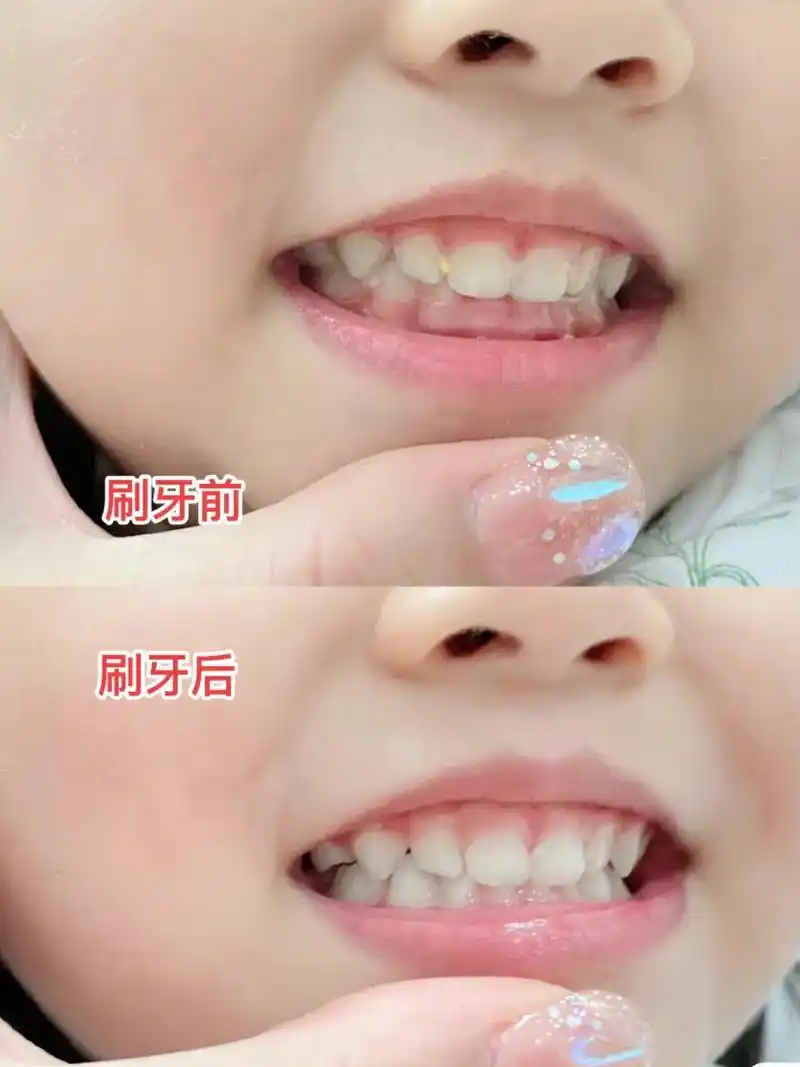 终于不用担心孩子的牙齿了07.