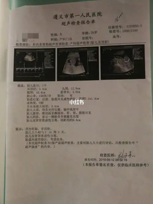 关于胎盘血池的那些事