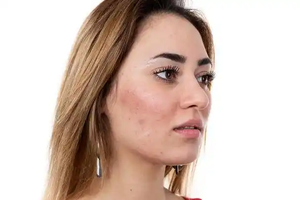 明明还很年轻,脸色却暗黄,皮肤粗糙,这些跟什么有关?怎么办?