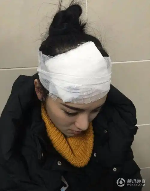 武大校花头被砸伤 黄灿灿受伤