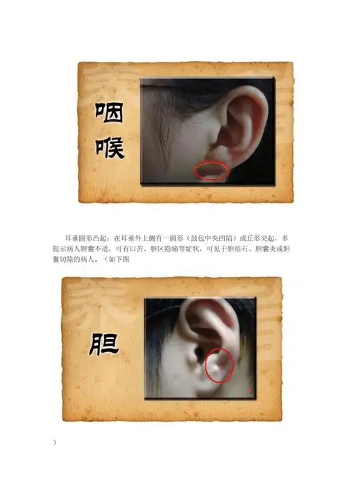 耳朵与身体各部位生的病的关系doc22页
