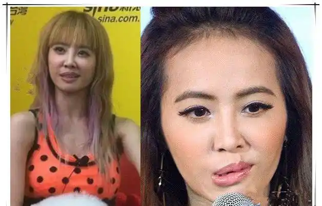 女星整容"后遗症"爆发!嘴歪是第一步,最后都成了"塑胶脸"