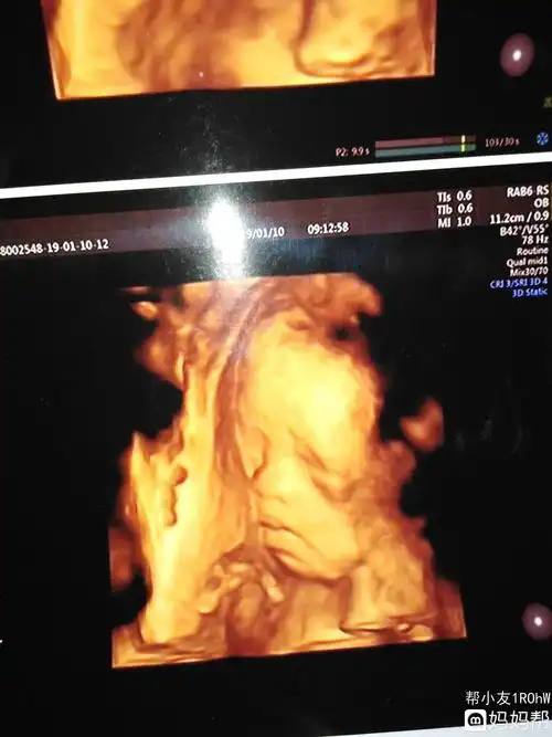 浑厚!六个月四维彩超男孩图"善始善终"-第1张图片-花纹博客