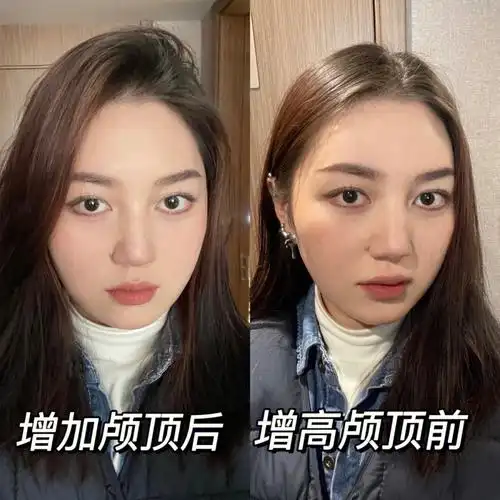 三分钟0成本get高颅顶还不快来学