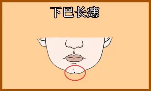 下巴长痣下巴即地阁,代表的是一个人的晚年运势与个人的聚财力大小等