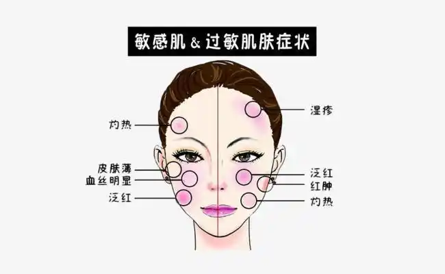 敏感肌的灭火器——舒敏专家