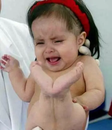 一条真实美人鱼医生推断其寿命最多还有十年罕见病例