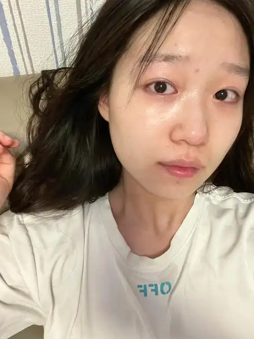 素颜原相机镜头下照出了像是家暴后的感觉