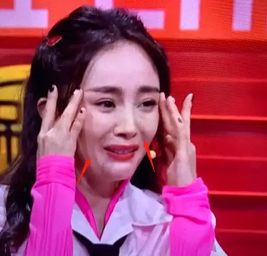 后遗症娱记曝杨幂整容后脸崩得很夸张还让节目将大笑镜头删掉