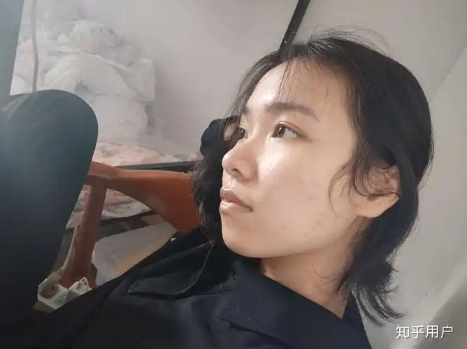 侧脸好看 但是正脸鼻翼大的脸型不好看,怎么办?