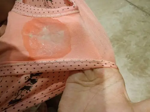 [有图]想问一下 今天发现白带浆糊状 内裤还湿了一片 有异味 应该是