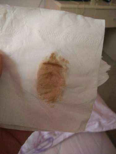 在怀孕初期的时候出现了褐色分泌物,孕妈认为这是一个生理分泌物没有
