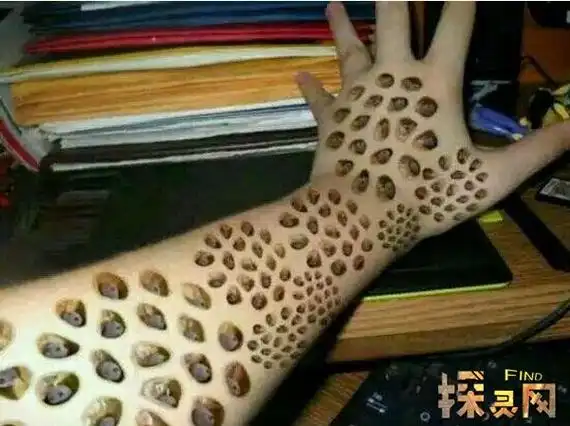 莲蓬乳和空手指,网络上最恶心的图片(胆小勿入)