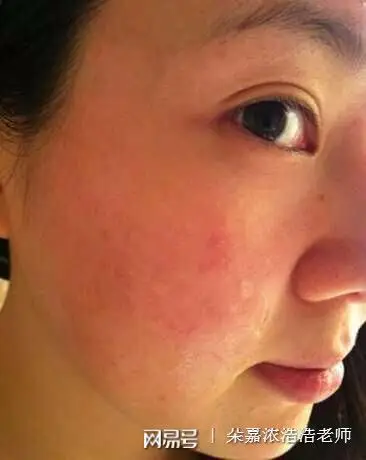 敏感肌肤经常按摩脸部皮肤会使皮肤变得更薄更敏感吗?