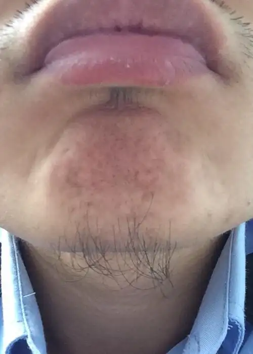 这胡子怎么样才能浓密不那么稀疏?