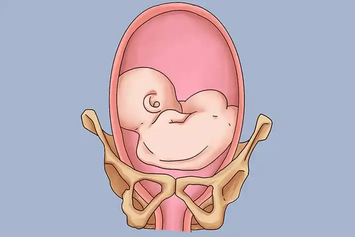 枕后位及枕横位可在前腹壁触及胎儿肢体,胎背偏向母体后方或侧方,且