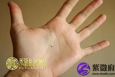 左掌心痣代表的是什么