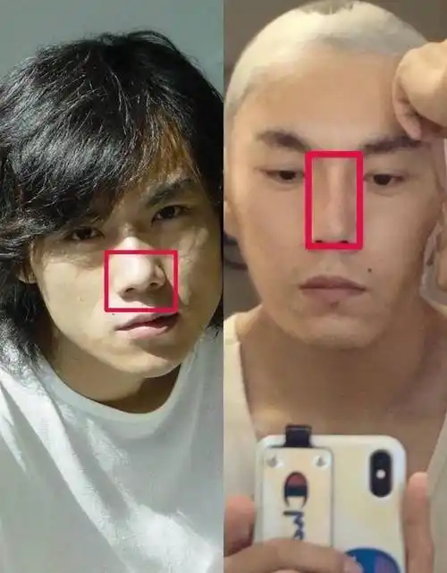 总之,在秦昊疑似整容前旧照曝光之后,诸多网友对此也是相当震惊,毕竟