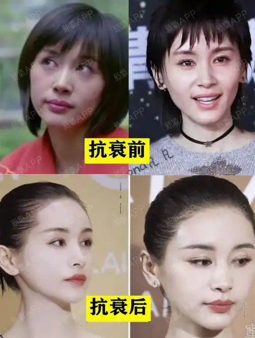 为什么王子文被称为抗衰教科书王子文给人的感觉是:越_圈子-新氧美容