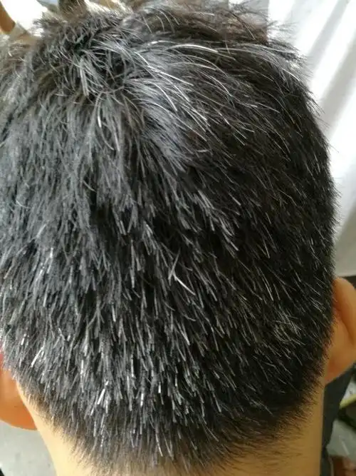 头发白了吃什么能变黑