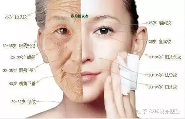 皮肤衰老这4个小细至关重要