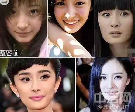 杨幂整容前后对比照片