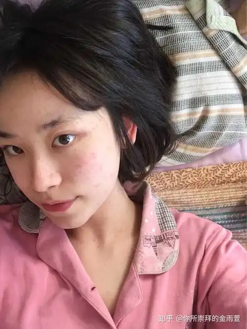 怎么看待五官漂亮但是皮肤差的女性