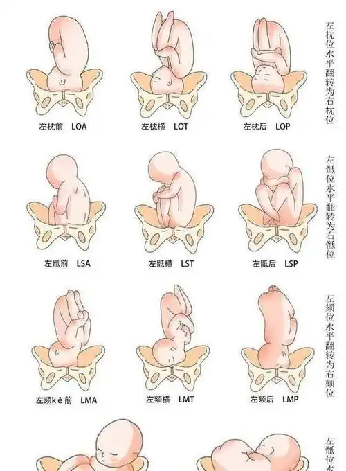 是指臀先露,胎儿的屁股朝下头朝上;横位:是指肩先露,胎儿处于横躺位