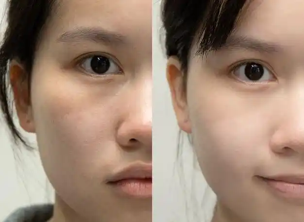 面霜|美白|保湿|洁面|果酸|爽肤水|敏感肌肤_网易订阅