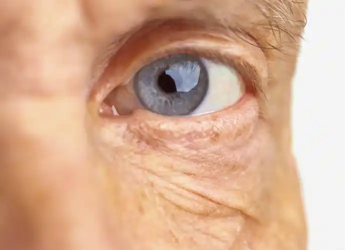 求一张单眼的图片,最好是真实的眼睛,不是二次的,左右眼无所谓,最好给