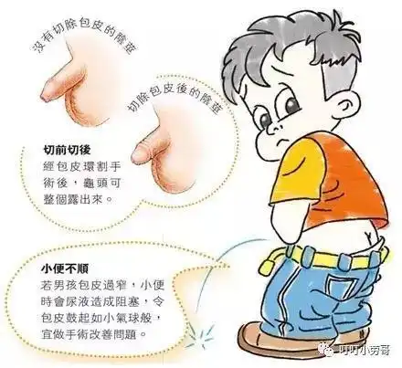 一分钟看实例图片了解包皮过长和包茎是什么样子