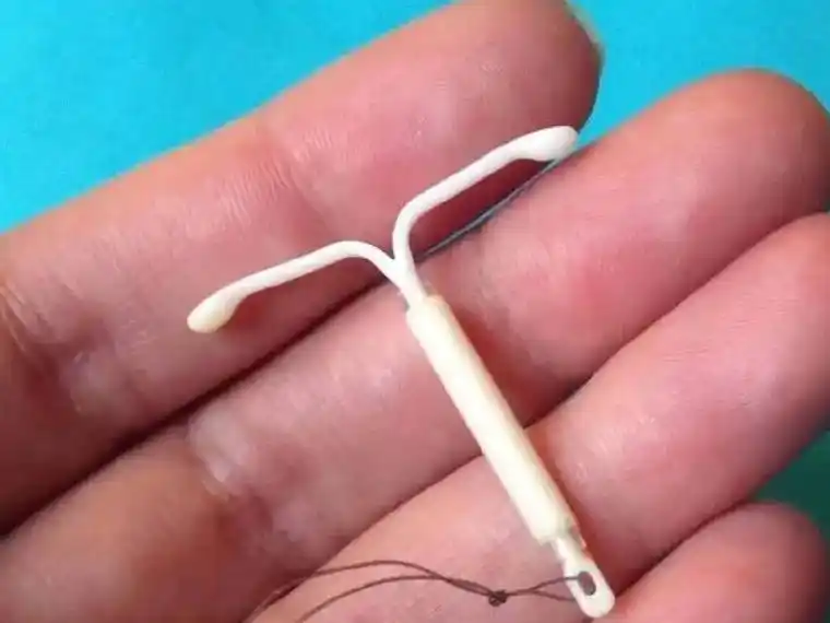 避孕环的形状图片汇总一文知晓宫形环宫喜环什么样