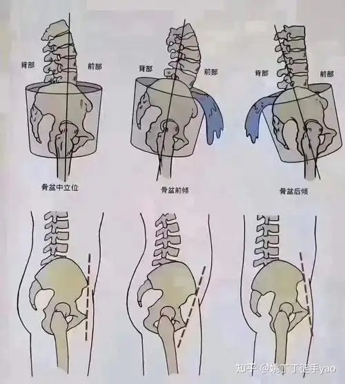 生完孩子后骨盆修补不能再盲目使用器械挤压,做过的都后悔