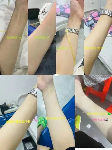 glutax 180w美白针_美白针_亳州万达广场攻略_万达广场_美白_黑黄皮